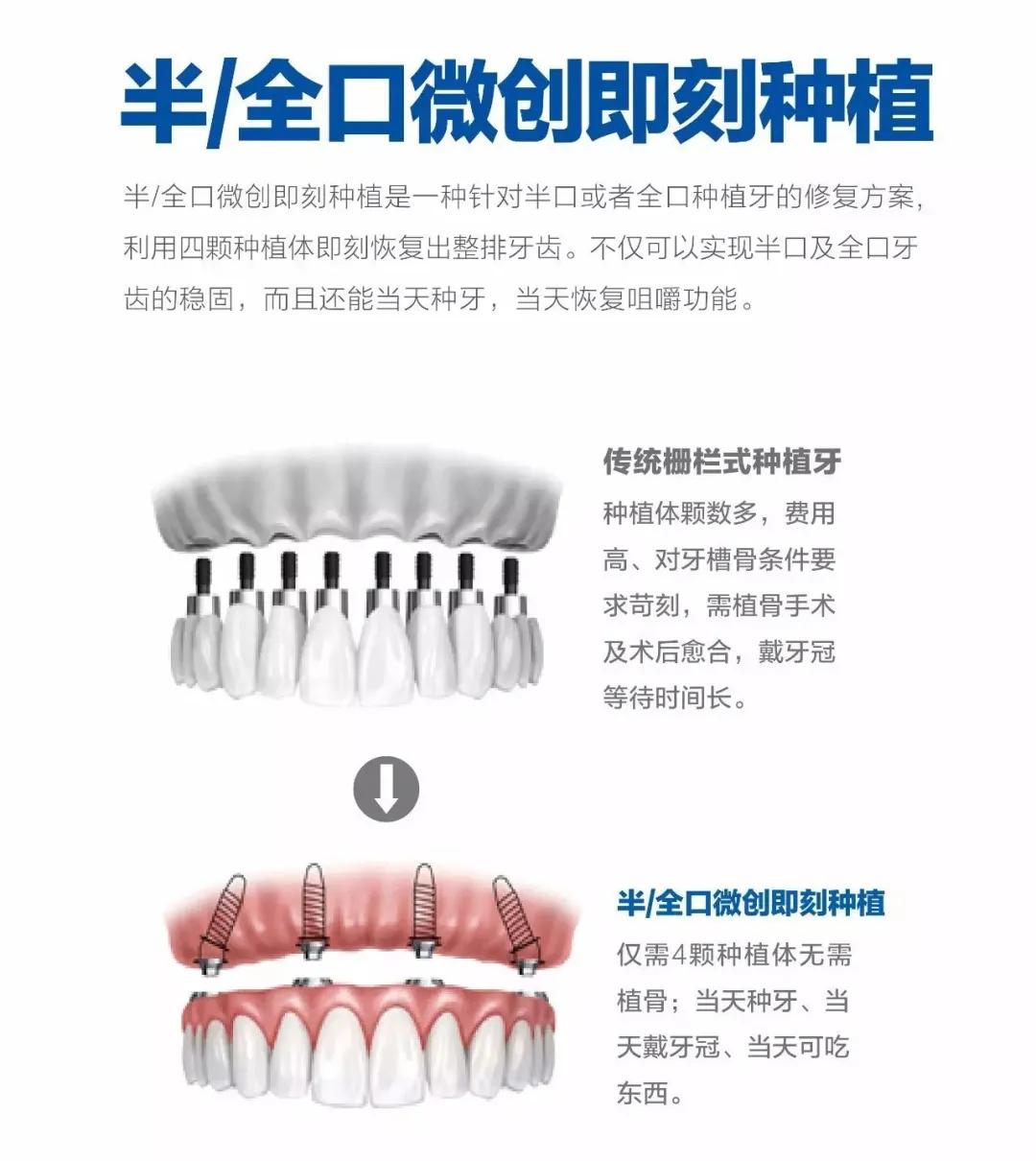 双十一最新活动方案揭秘